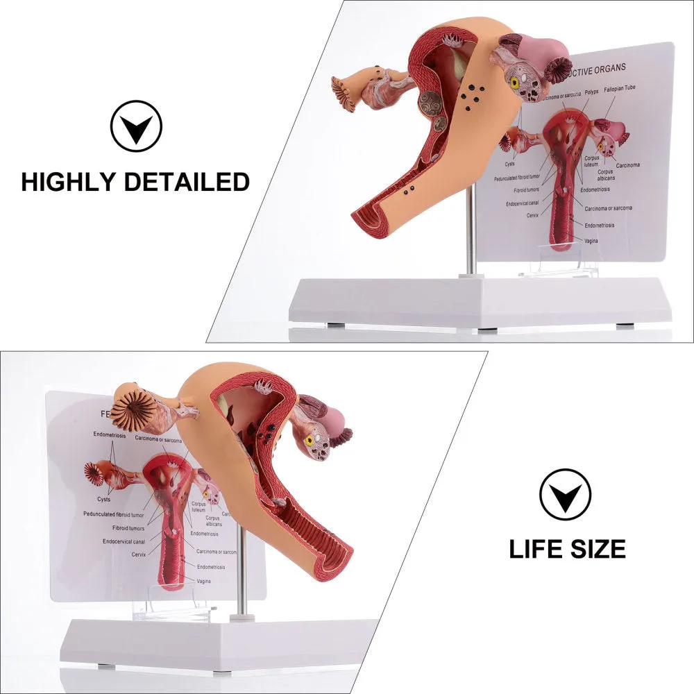 1Pc Female Reproductive Organs Anatomy Model Uterus Model for