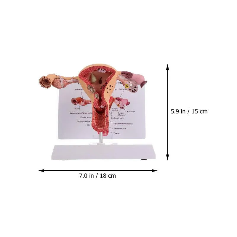 1Pc Female Reproductive Organs Anatomy Model Uterus Model for