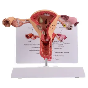 1Pc Female Reproductive Organs Anatomy Model Uterus Model for