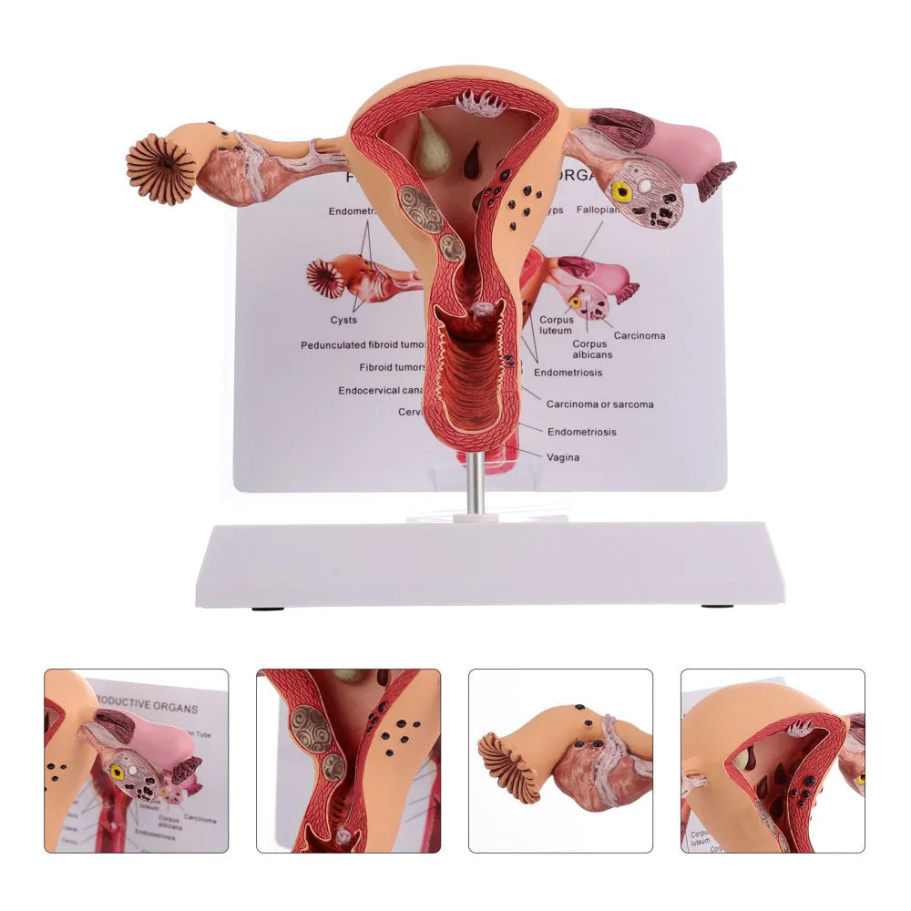 1Pc Female Reproductive Organs Anatomy Model Uterus Model for