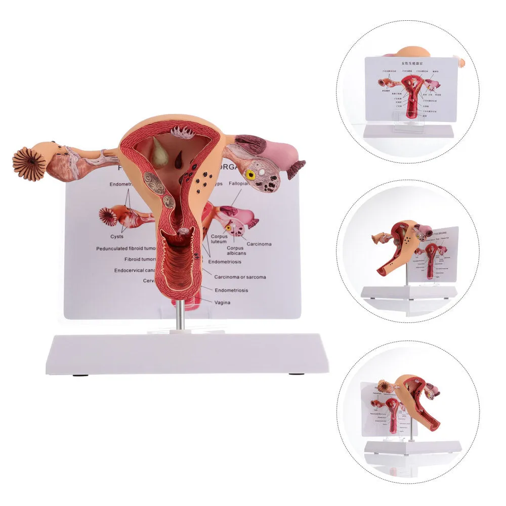 1Pc Female Reproductive Organs Anatomy Model Uterus Model for